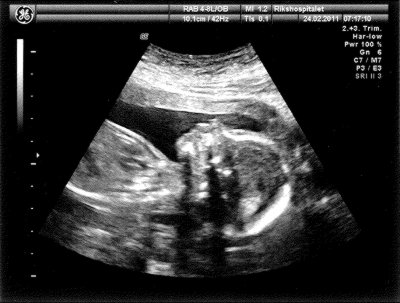 [Sonogram]